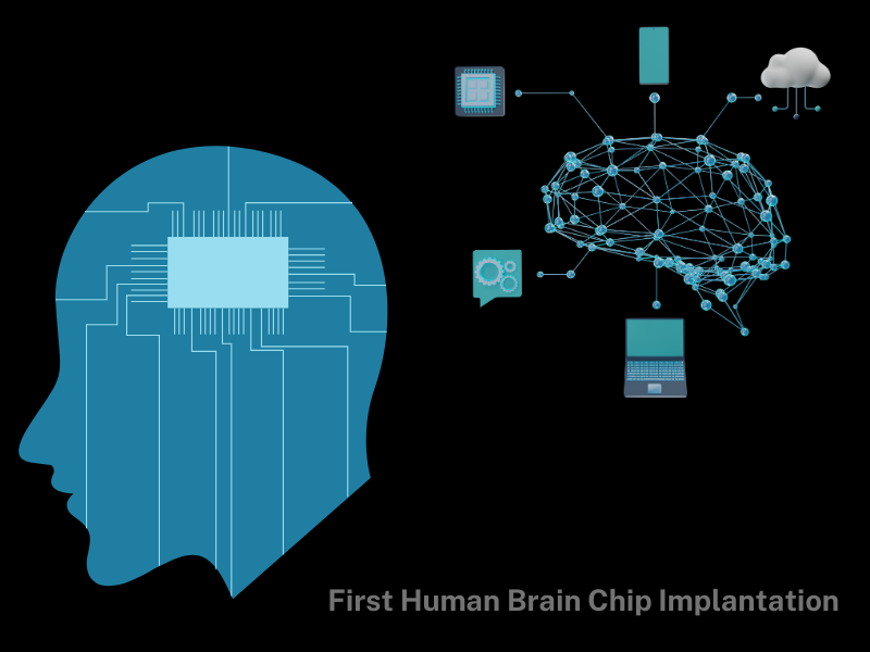 First Human Brain Chip Implantation, neuralink, elonmusk